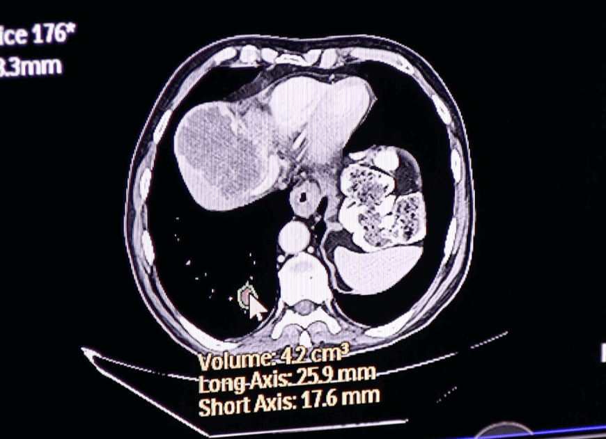 medical malpractice