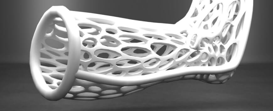 Plaster Casts On A Broken Limb In 2017? Please Print Out Mine!