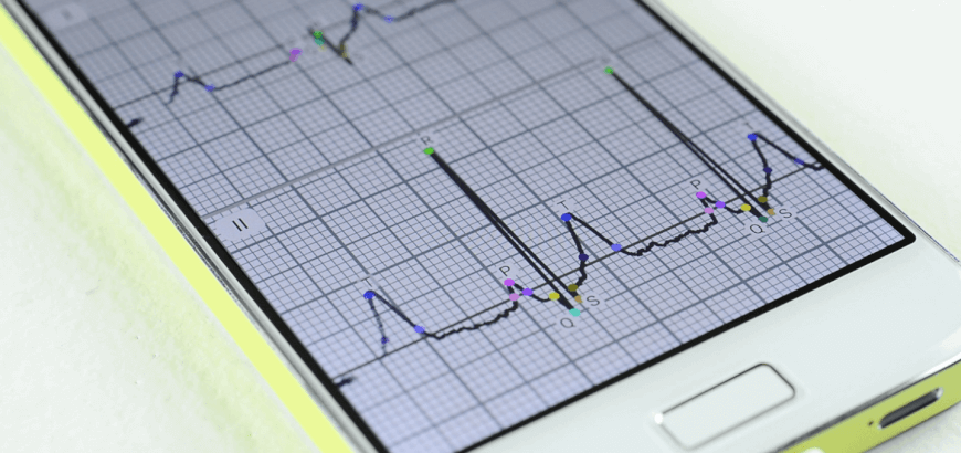 The Multichannel ECG on Your Smartphone: The ECG Dongle Review